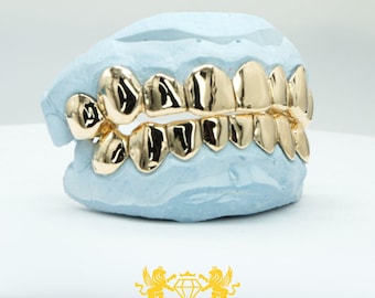 Custom Grillz: Yellow Gold Finish, Silver 925, 10K/14K Gold, Free Mold Kit