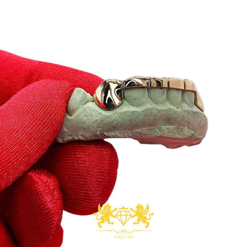 Custom 6-piece rose gold grillz set featuring solid canine caps connected by a horizontal bridge bar held in glove