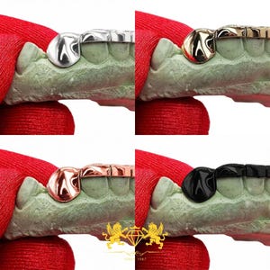 Close-up view of smooth mirror-polished rose gold bridge bar connecting two solid canine teeth caps