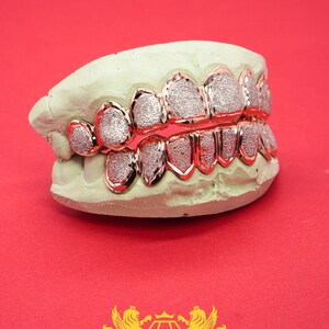 Personalized Dental Jewelry designed just for you.