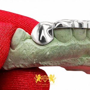 Front profile view of custom fitted rose gold bar and canine fangs grillz set on dental cast