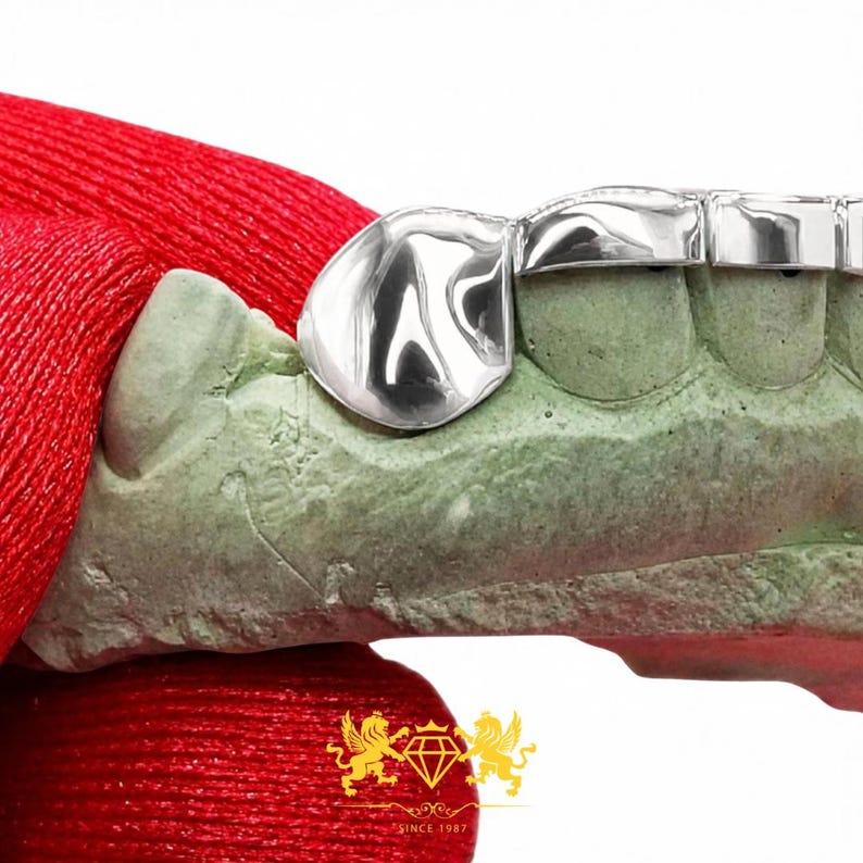 Front profile view of custom fitted rose gold bar and canine fangs grillz set on dental cast
