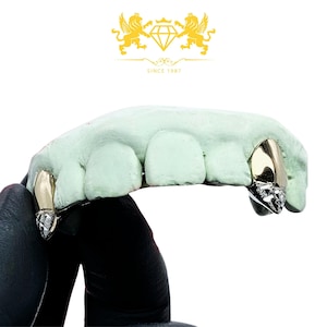 Diamond Dust Fang Grillz: Custom Fit, Silver, Gold (Free Mold Kits)