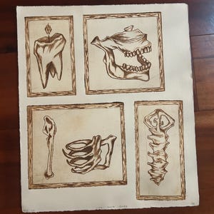 May include: Anatomy-themed artwork featuring five framed illustrations of human skeletal elements. The drawings, in shades of brown, include a tooth with a flame, a jaw, a rib cage, a bone, and a spine. The text "NOT ACID SAFE" is visible.