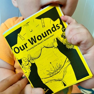 May include: A yellow zine with black illustrations and the title "Our Wounds: A Caring Zine About C Section Scars".