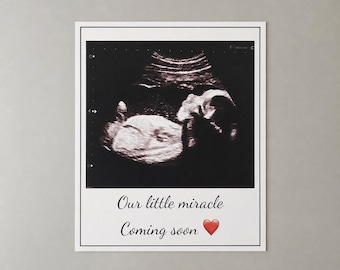 Ultrasound Magnet, Custom Photo Magnet, Baby Announcement Magnet, Pregnancy Announcement Idea For Grandparents, Sonogram Picture Magnet Gift