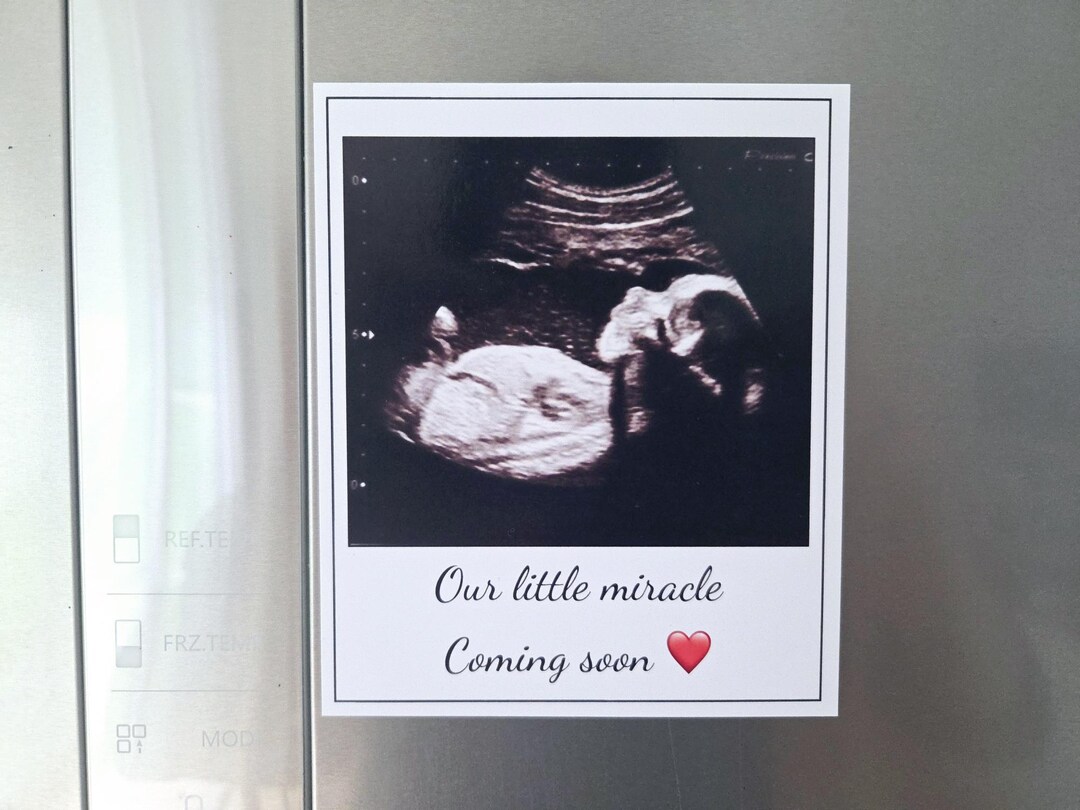 Sonogram Magnets Ultrasound Magnet, Custom Photo Magnet, Baby Announcement Magnet ...
