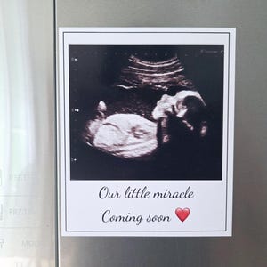 Ultrasound Magnet, Custom Photo Magnet, Baby Announcement Magnet, Pregnancy Announcement Idea For Grandparents, Sonogram Picture Magnet Gift