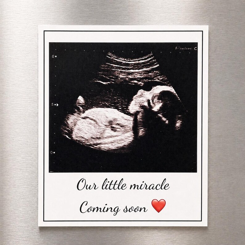 Sonogram Magnets Ultrasound Magnet, Custom Photo Magnet, Baby Announcement Magnet ...