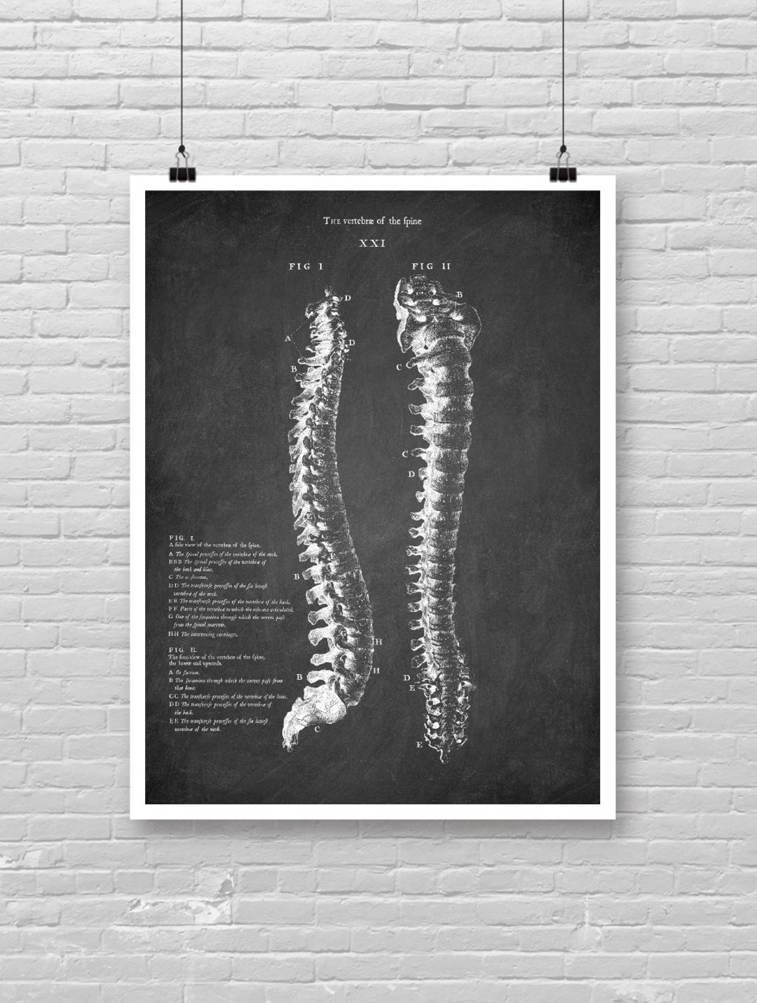 Anatomical Spine Bones Print, Vertebral Column Drawing Poster, Skeleton ...