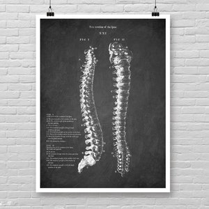 Anatomische wervelkolom botten print, wervelkolom tekening poster, skelet detail grafiek poster, anatomische skelet print, medische wand decor