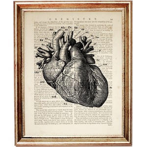 Anatomisches menschliches Herz Kunstdruck, Anatomie Wandkunst, Medizinisches Wörterbuch Seite Kunst, Herz Wanddekor, Anatomie Diagramm Poster