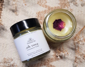 May include: Two glass jars of treatment balm. One jar is closed with a black lid, the other is open, revealing a yellow balm with a dried rose petal. The label reads "Inhale Botanicals .oh rosa. treatment balm".