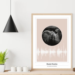 Aquarell Kunst fetaler Ultraschall, personalisierte Baby Poster, Ultraschallbild, fetale Ultraschallbild, Mutterleib Porträt