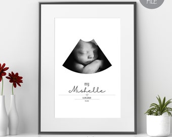 Personalized Baby Poster, Ultrasonic Image, Fetal Ultrasound Picture, DIGITAL FILE