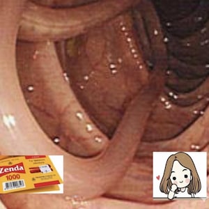 Detox & Digestive Balance | Natural Body Cleanse Support