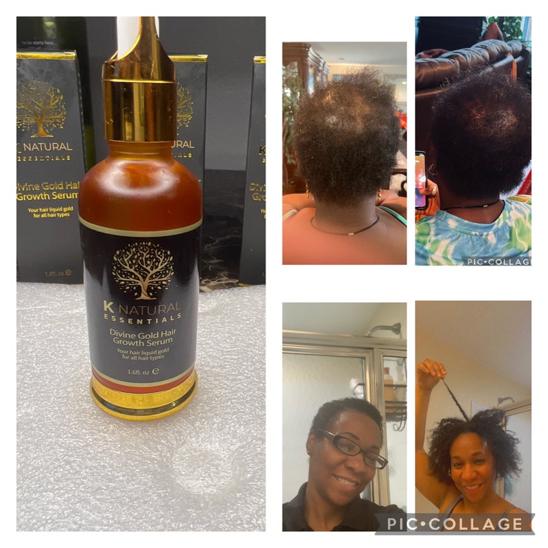 Super Hair Growth Serum Etsy