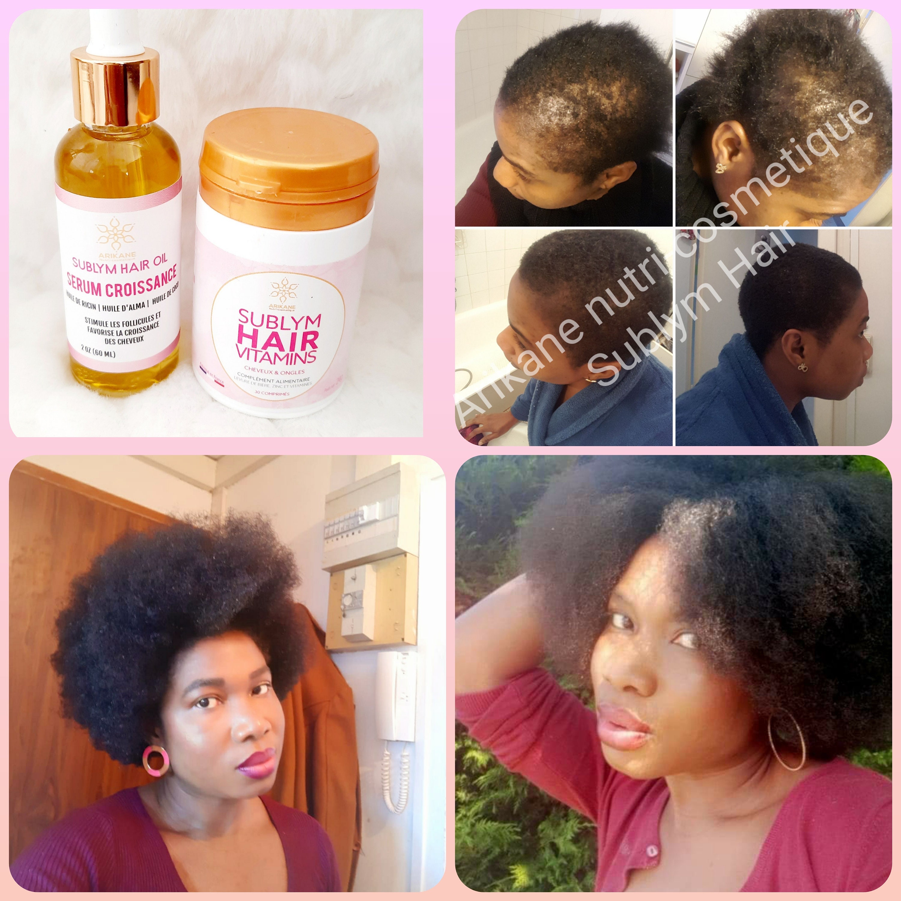 Duo Oil and Vitamins Hair Growth Sublym Hair - Etsy Canada Duo Oil and Vitamins Hair Growth Sublym Hair - Etsy Canada
