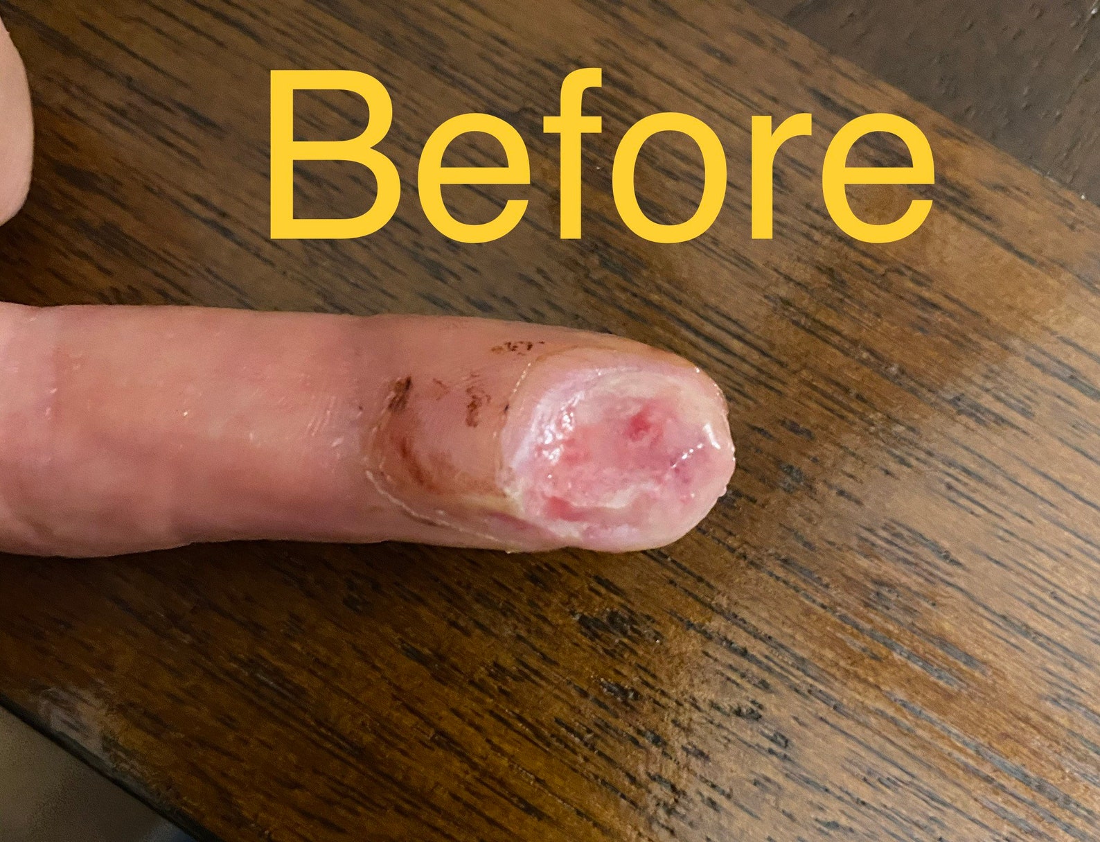 Amazing Antibiotic Wound Care Ointment Etsy