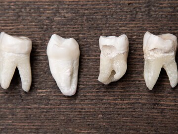 10 Real Human Teeth (Molars, Premolars, & Anteriors)