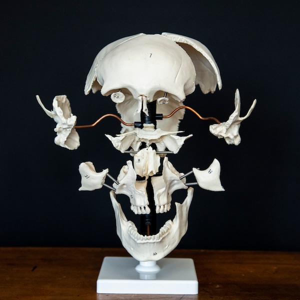 Exploded Human Skull - Beauchene Skull Model - Medical Display Model for Education or as Oddity Decor