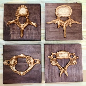 Wooden Vertebrae art set of four - Cervical, Thoracic, Lumbar and the Atlas