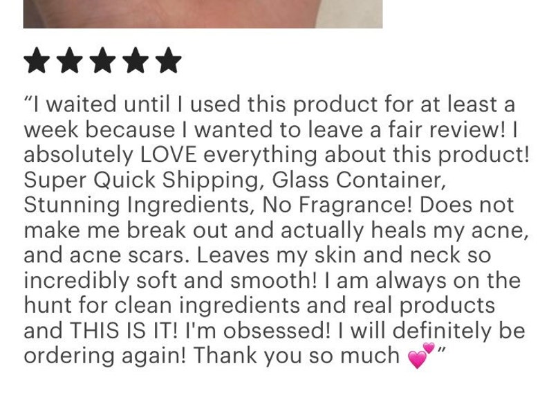 Pode incluir: Uma avalia&ccedil;&atilde;o do cliente com uma classifica&ccedil;&atilde;o de cinco estrelas. O texto elogia o produto, mencionando 'Ingredientes Impressionantes' e 'Sem Fragr&acirc;ncia'. A avalia&ccedil;&atilde;o destaca os efeitos positivos na pele, incluindo a cura da acne e maior suavidade. O revisor expressa satisfa&ccedil;&atilde;o e planeja pedir novamente.