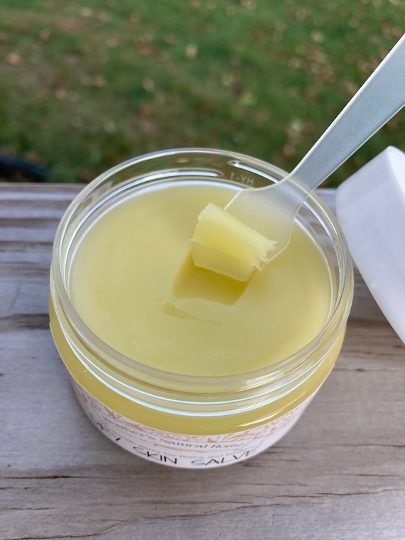 Healing Salve: Ultra Dry Cracked Skin Balm with Calendula & Rosehip, Salve for Dry Skin, Extreme Dry Skin Balm, Eczema salve