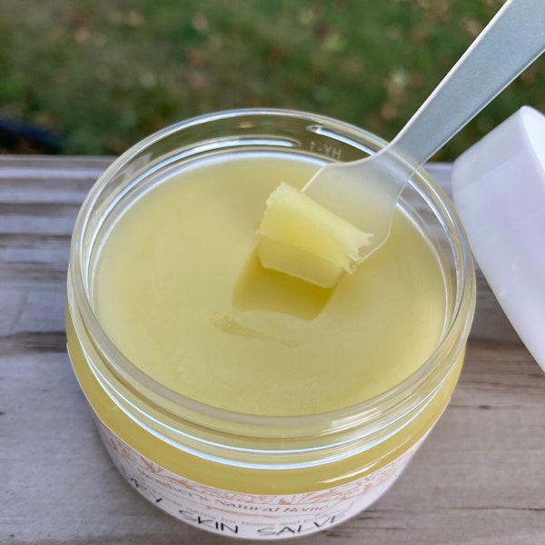 Healing Salve, 2 sizes Dry Skin Balm, Extreme Dry Cracked Skin Salve, Moisturizing Lotion, Skin Repair Cream, All purpose salve