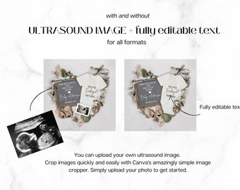 IVF Pregnancy Announcement Digital, Editable Baby Pregnancy Reveal, Love &  Science Baby Reveal, Little Embryo That Could, Flat Lay -  Denmark