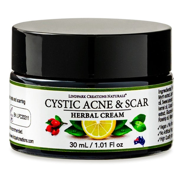 CYSTIC ACNE & SCAR Herbal Cream - Pimples, Milia, H.S., Folliculitis, Teen Acne and More