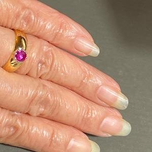 Puede incluir: Primer plano de una mano con un anillo de oro con una piedra preciosa rosa. Las uñas no están pintadas y tienen un ligero tono amarillento.