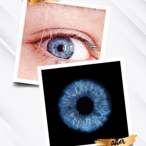 May include: Before and after image of a blue eye. The before image shows the eye with a visible blood vessel. The after image shows the eye with the blood vessel removed.