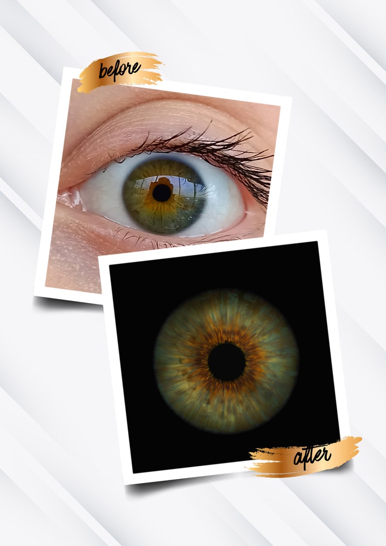 May include: Before and after image of a human eye. The before image shows a green eye with a brown iris. The after image shows a close-up of the iris, which is a mix of brown, green, and gold.