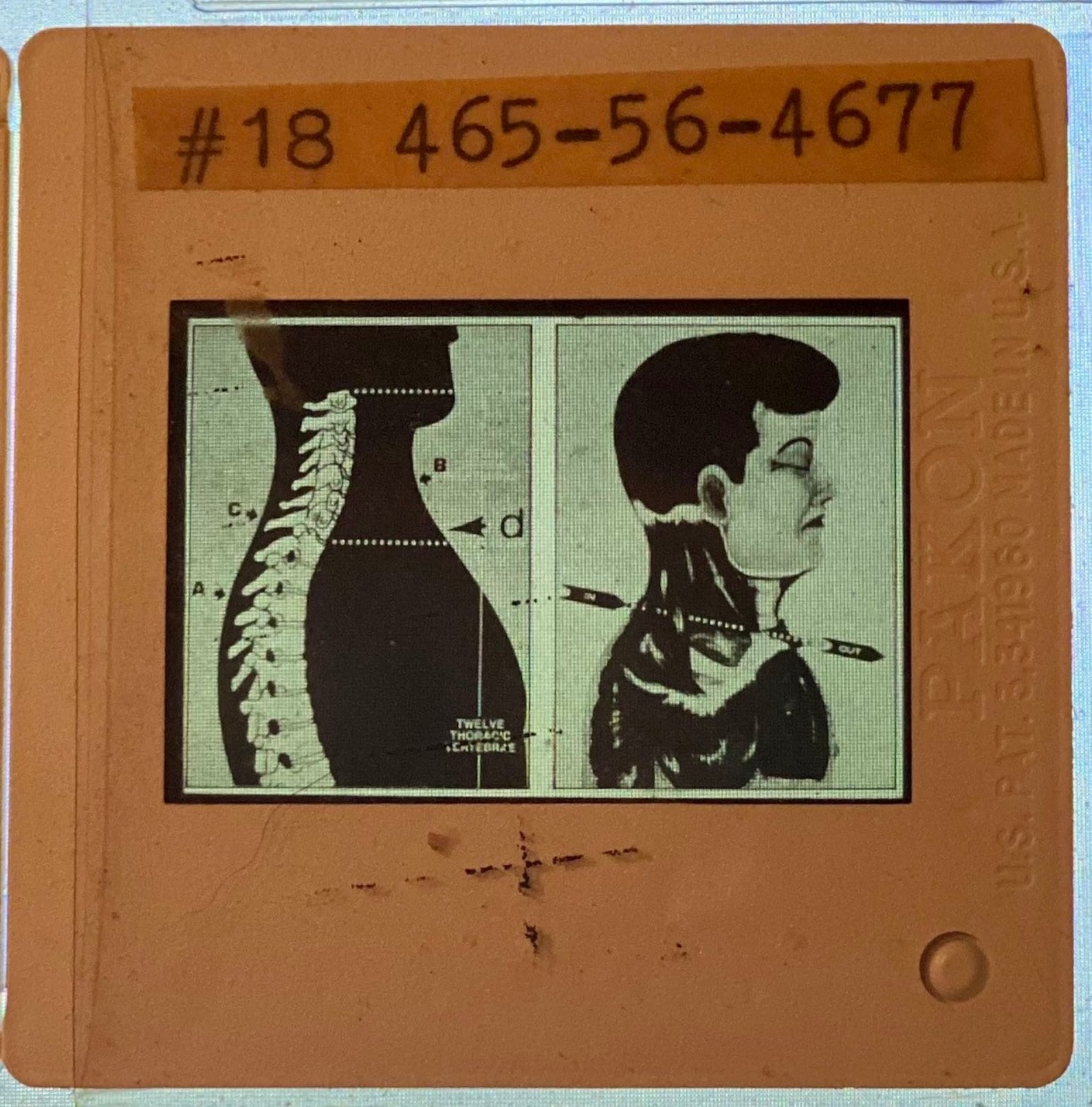Slides of Drawings of JFK Autopsy Photos Used in Warren Etsy Australia