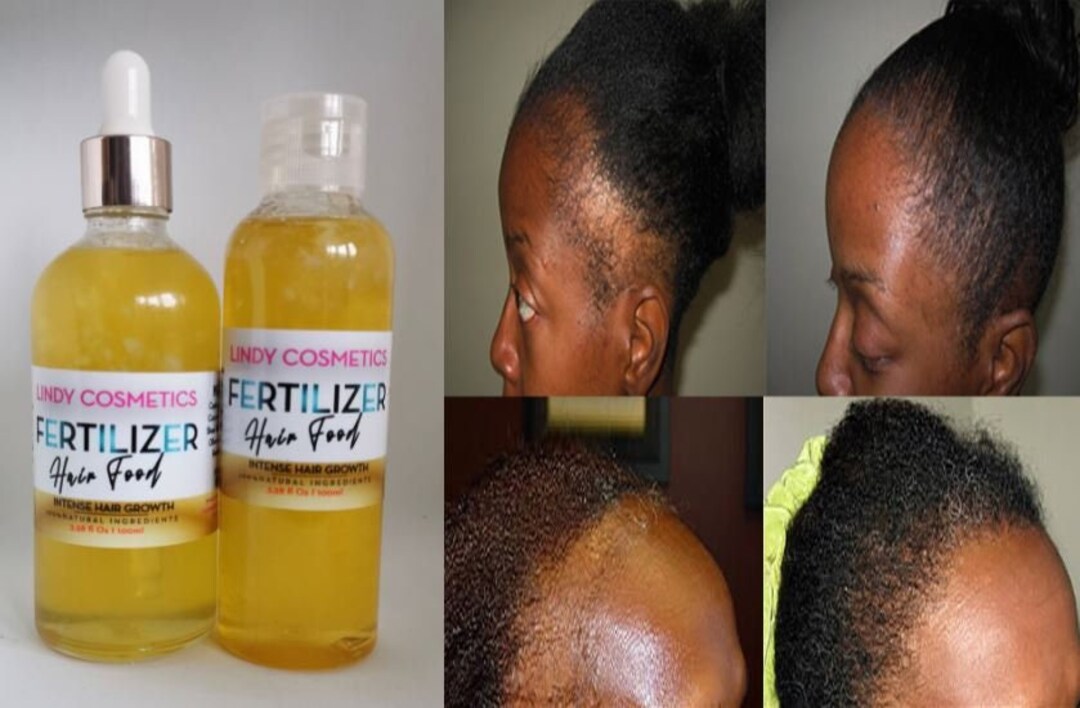 Hair Growth FERTILIZER OIL 100 Premium & Authentic Etsy UK