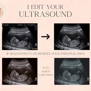 May include: A digital graphic displaying ultrasound images with the text I EDIT YOUR ULTRASOUND, IF REQUESTED I CAN REMOVE YOUR PERSONAL INFO, and SCAN DESIGN VARIATIONS. The layout shows a before and after comparison of a fetal sonogram.