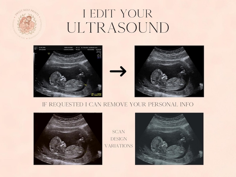 May include: A digital graphic displaying ultrasound images with the text I EDIT YOUR ULTRASOUND, IF REQUESTED I CAN REMOVE YOUR PERSONAL INFO, and SCAN DESIGN VARIATIONS. The layout shows a before and after comparison of a fetal sonogram.
