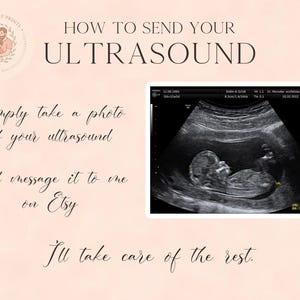May include: A light pink instructional graphic with the text HOW TO SEND YOUR ULTRASOUND, Simply take a photo of your ultrasound and message it to me on Etsy, I'll take care of the rest. It includes a black and white fetal ultrasound image.