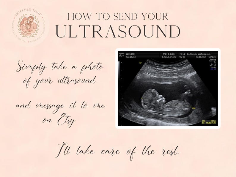 May include: A light pink instructional graphic with the text HOW TO SEND YOUR ULTRASOUND, Simply take a photo of your ultrasound and message it to me on Etsy, I'll take care of the rest. It includes a black and white fetal ultrasound image.