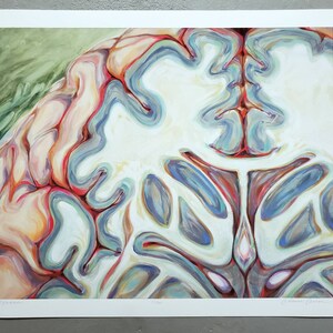 Examen - Limited Edition Giclee Fine Art PRINT