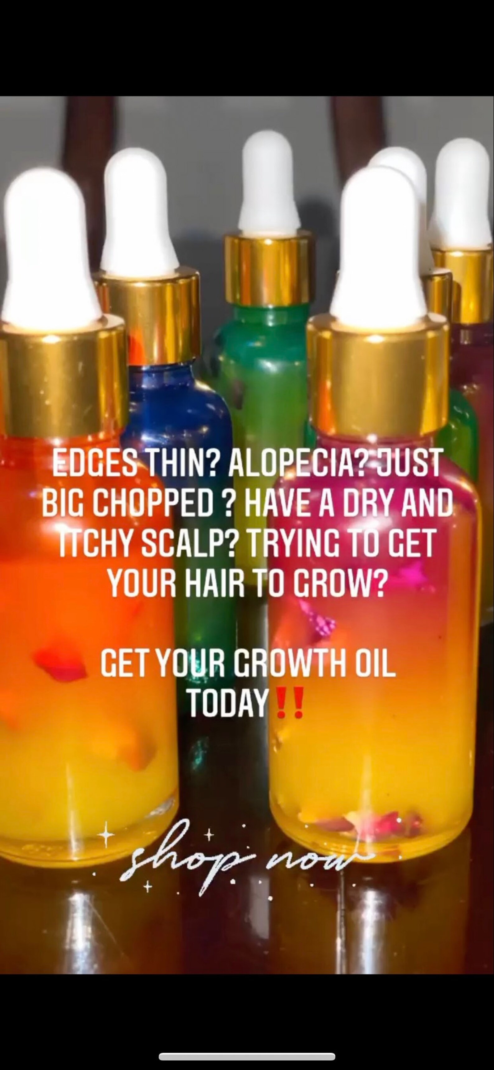 1oz infused Scalp Stimulating Growth Oil Mega Growth Hair Etsy