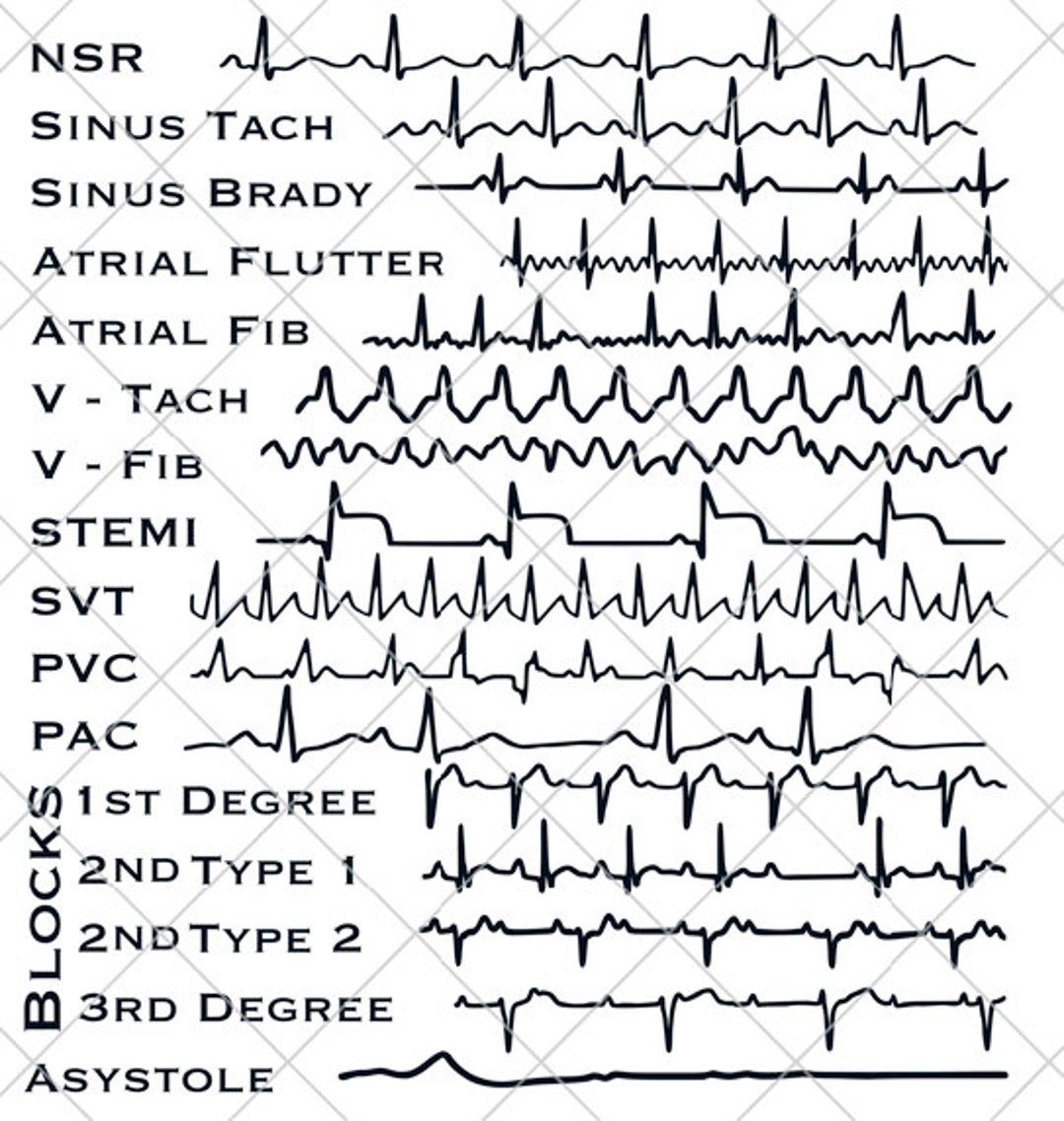 Ekg strips svg cardiac monitor nurse technician doctor gift