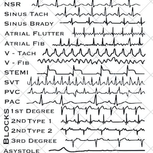 EKG Strips SVG | Cardiac Monitor | Nurse, Technician, Doctor Gift | Digital Download