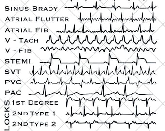 EKG Strips SVG | Cardiac Monitor | Nurse, Technician, Doctor Gift | Digital Download