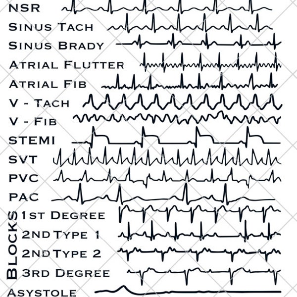 EKG Strips SVG | Cardiac Monitor | Nurse, Technician, Doctor Gift | Digital Download