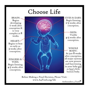 May include: A blue illustration of a baby with red lines highlighting different stages of development. The text reads "Choose Life" and includes information about the development of the brain, heart, fingers and toes, eyes and ears, skin, and whole body at different weeks after conception. The text also includes the website address "www.A4Truth.org/life" and the phrase "Ambassadors 4 Truth".