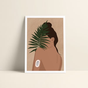 Postkarte Din A6 "palm leaf" | Diabetes Art | Diabetes Illustration | Girls with Gadgets | Diabetes Typ 1 | Dexcom G6