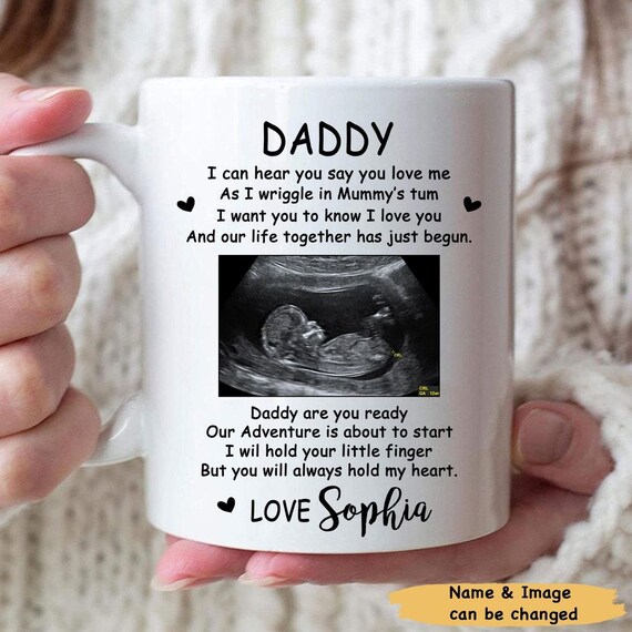 Personalized Custom Name Sonogram Ultrasound Coffee Mugs gifts idea Daddy  To Be, Father's Day Gift for New Dad Mug