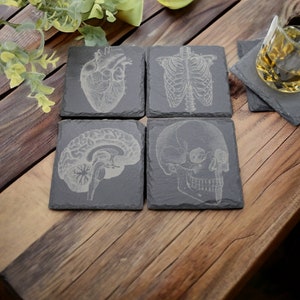 Vintage Anatomy Art Slate Coasters – Perfect Radiology Tech Gift, Set of 4, Unique Medical Decor